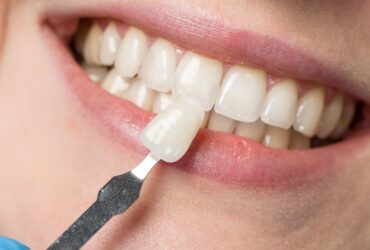 Cosmetic Dentistry