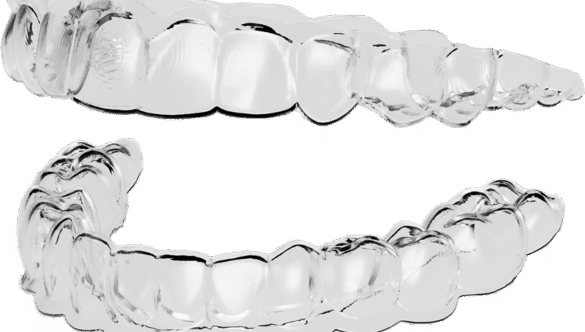 Invisible Teeth Straightening Options for Adults: What Are the Alternatives to Braces?