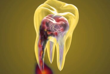 Endodontics