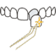 aesthetic dentistry wakefield