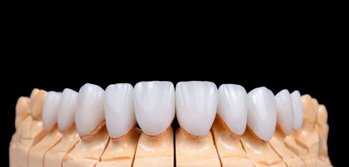 ceramic veneers wakefield