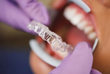 Orthodontics