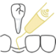 tooth extractions Wakefield