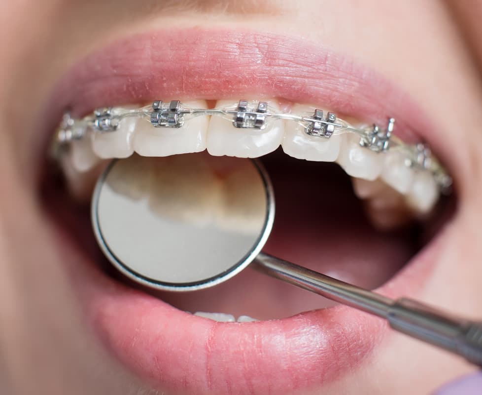 How often do i need to floss
