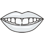 Fixed Braces