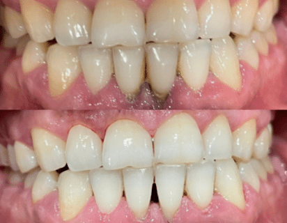 CAse Study 14