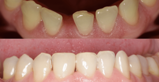 CAse study 11