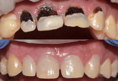 Case Study 12