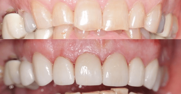 Case Study 6
