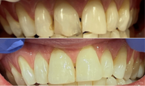 Case Study 8