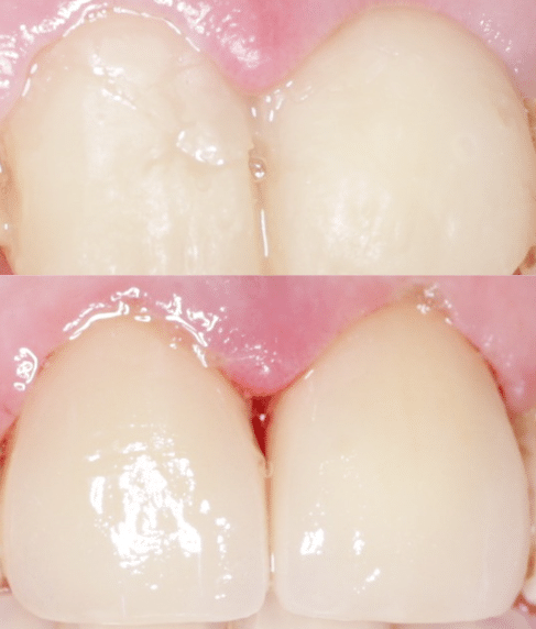 Case sTudy 5