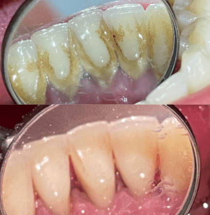 Case study 15