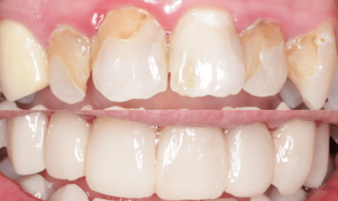 Case study 9