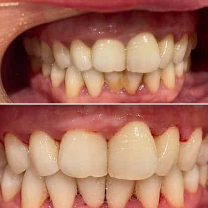 dental hygenist wakefield