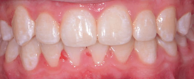 image (1)