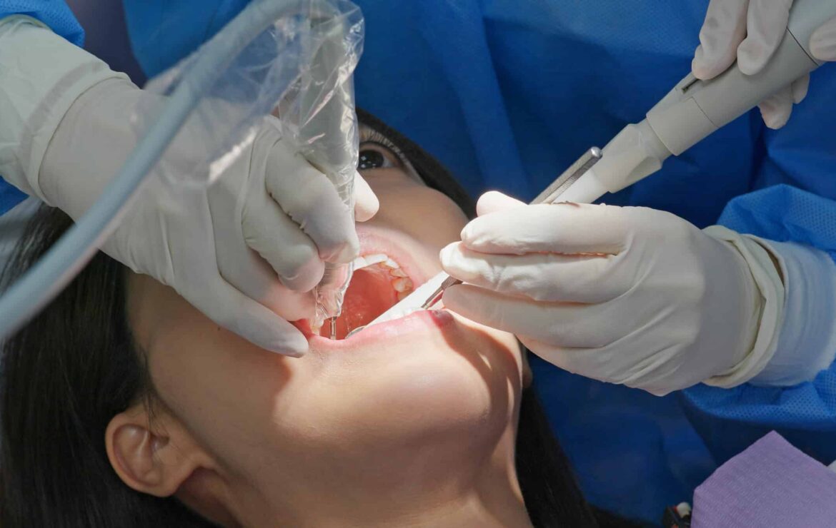 What Happens During a Root Canal? Step-by-Step Explained