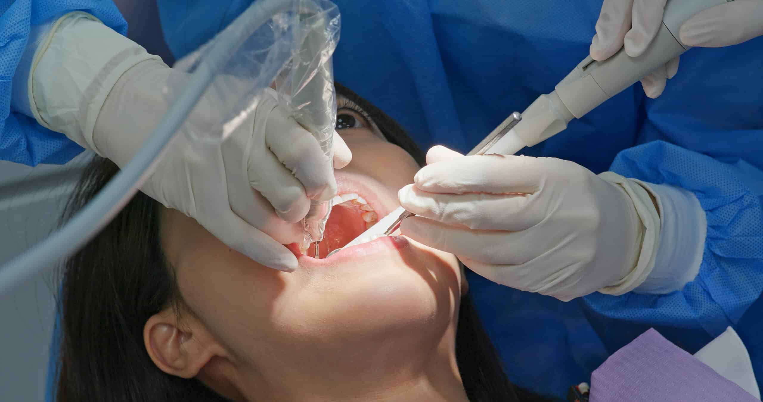 Woman undergo dental scaling treatment