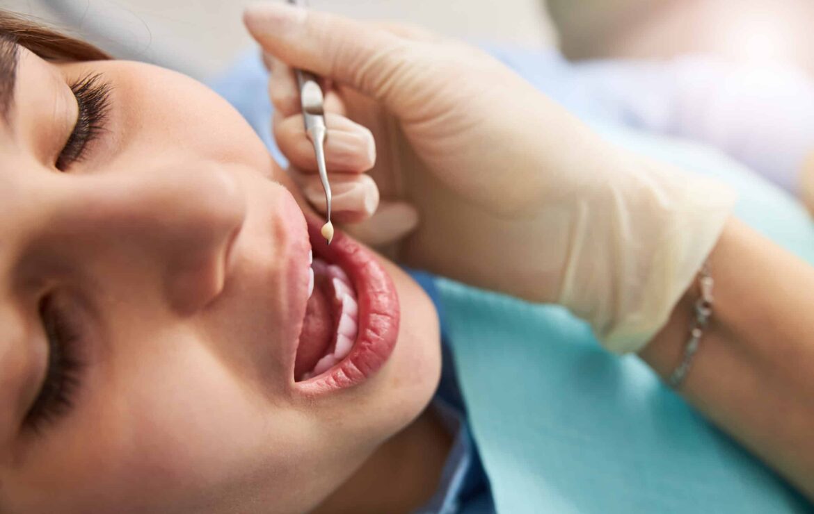 What To Do If Your Old Fillings Are Failing