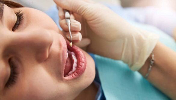What To Do If Your Old Fillings Are Failing