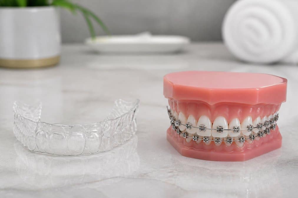 Adult Teeth Straightening: Invisalign & Braces Guide 2026