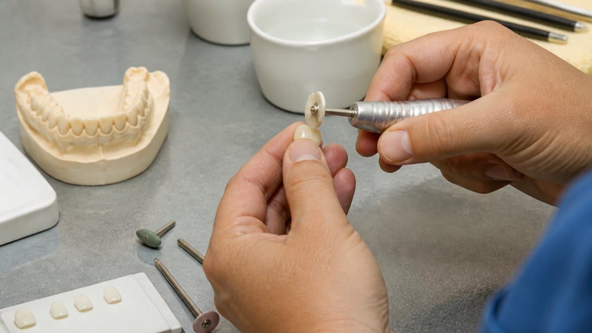 How to Fix Stained Dental Veneers: A Step-by-Step Guide